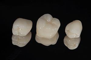 dental crowns sitting on a countertop